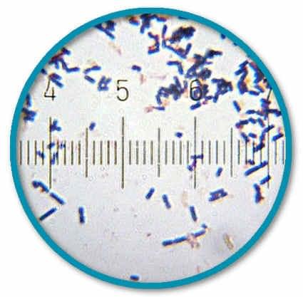 L. Acidophilus